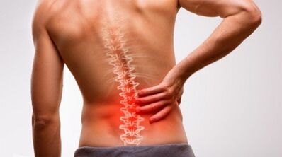 Lumbar bizkarrezurraren osteokondrosiaren seinaleak eta sintomak