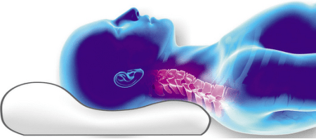 bizkarrezurra buruko ortopediko baten gainean jartzea