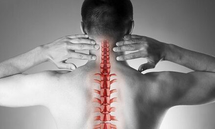 Nola agertzen da zerbikal bizkarrezurraren osteokondrosia